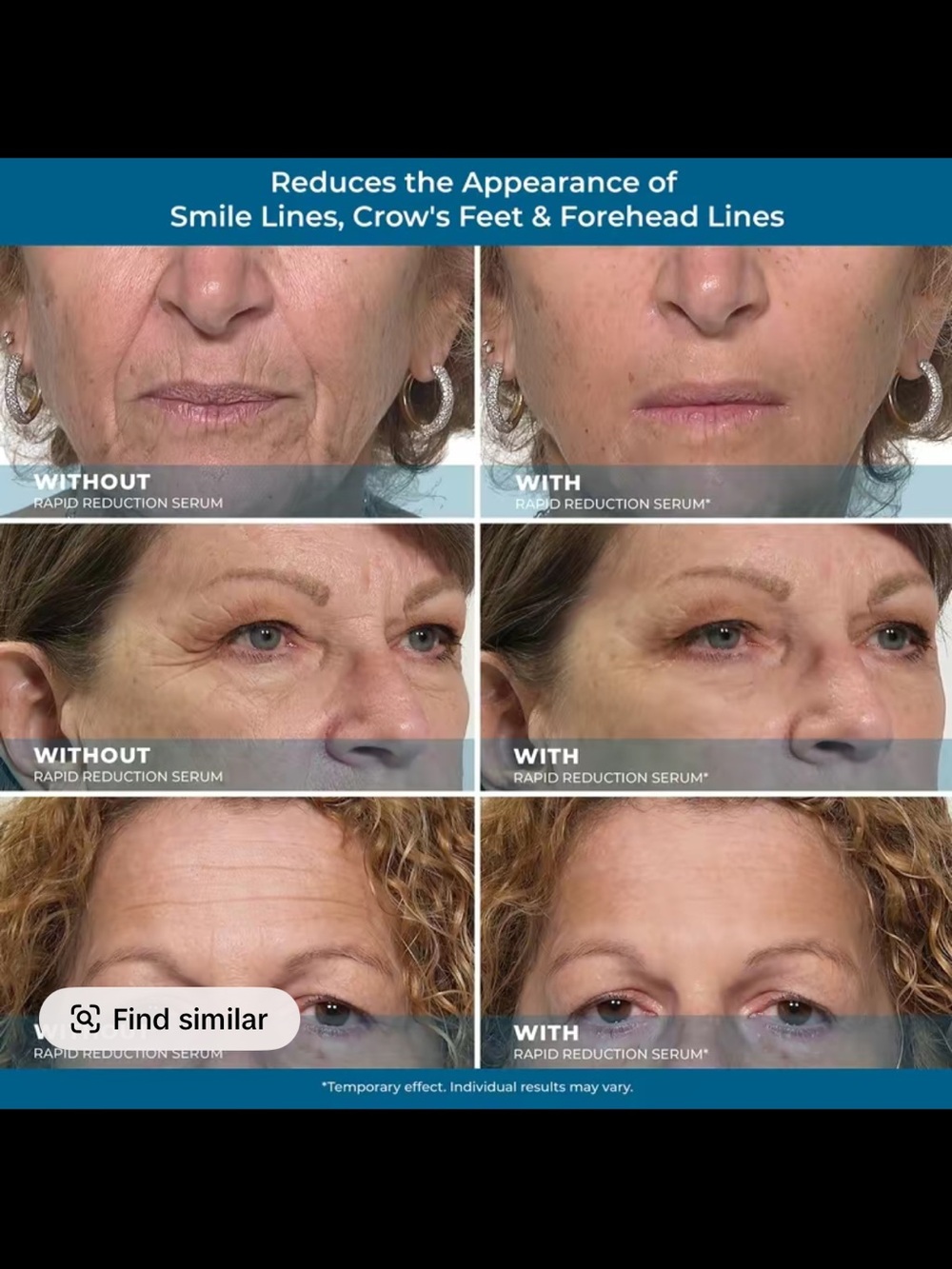 Plexaderm Rapid Reduction Eye Serum - Anti Aging Wrinkle Remover for Face, 10ml - Picture 5 of 8